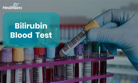 bilirubina 1 in urina|Bilirubin Test: Understanding High vs. Low Levels & Its Causes